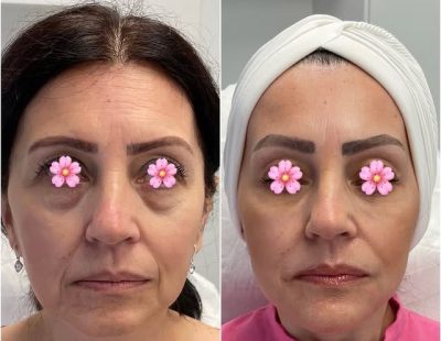 prise-en-charge-globale-du-visage